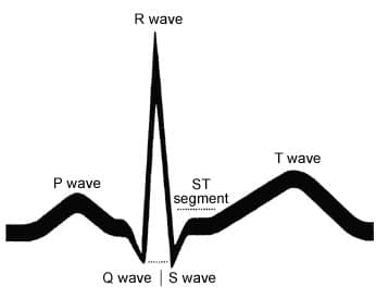 346x275 understanding an ecg geeky medics