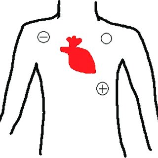 320x320 diagram illustrating lead ii placement of ecg leads download