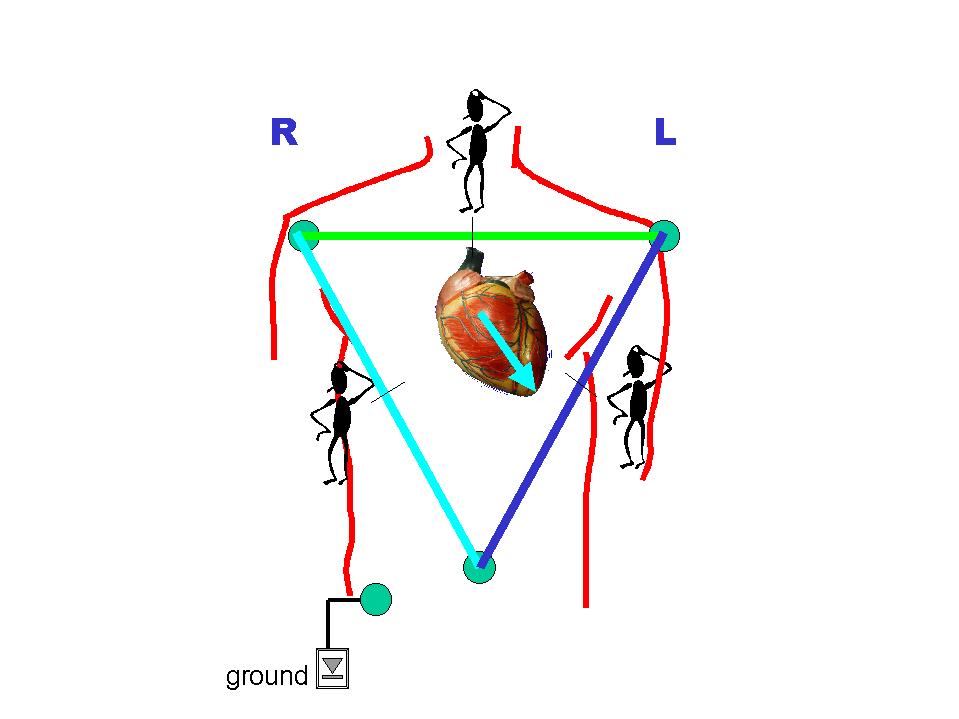 959x719 ecg primer the mean electrical axis