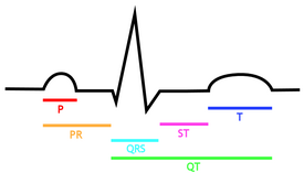 275x157 Drawing Of The Ekg, With Labels Of Intervals Medhelper