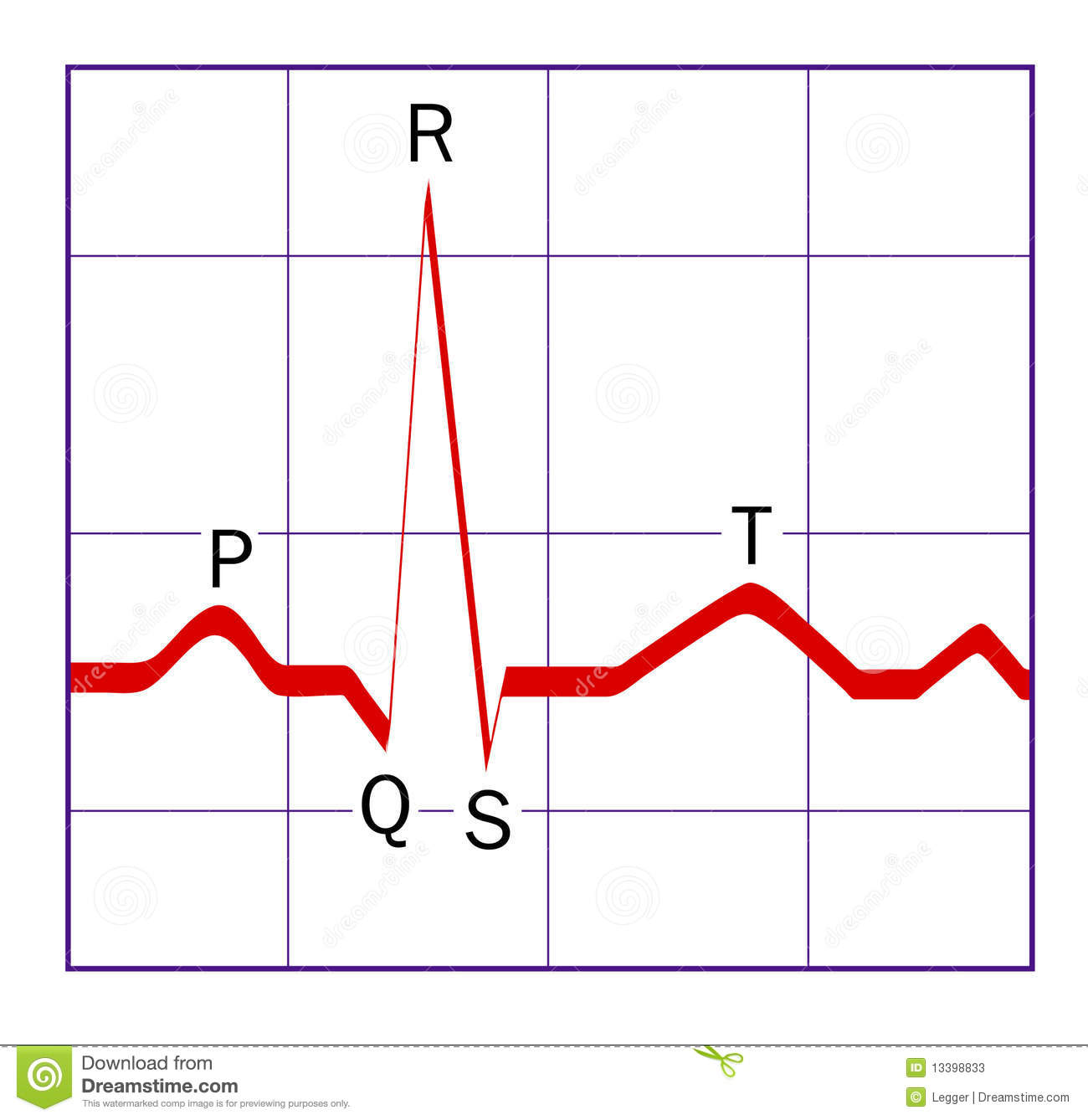 1300x1338 How To Draw An Ekg Tracing With Tikz