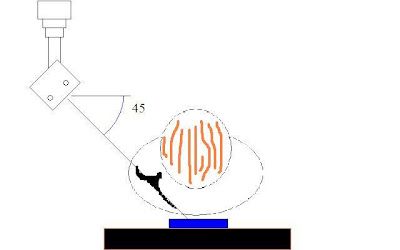 400x250 My Own Trauma Y View Method