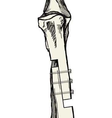 367x385 Radius And Ulna Veterian Key