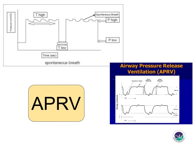 638x479 How To Initiate Mechanical Ventilation In Emergency Room