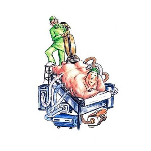 300x300 Extreme Lipo Drawing