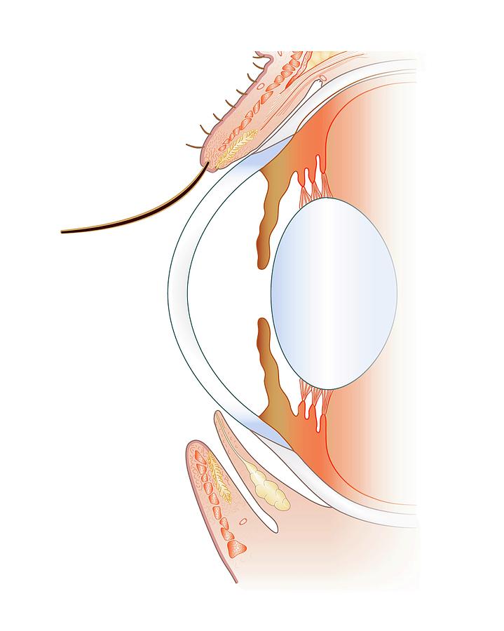 719x900 Front Anatomy Of The Eye Photograph