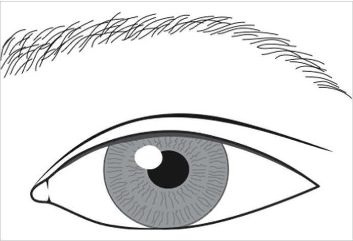 698x476 Figure From Comprehensive Review Of Asian Cosmetic Upper Eyelid