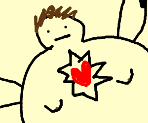 300x250 Fat Man Gets Open Heart Surgery