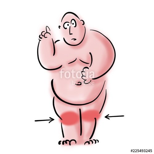 500x500 Fat Man Talking About Knee Pain Stock Photo And Royalty Free