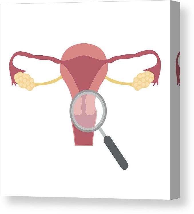 678x750 Medical Inspect, Test Female Reproductive System Canvas Print