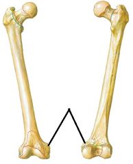 194x240 gross anatomy unit pelvis and femur bones foreign language