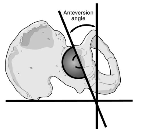 499x448 Tha Stability Techniques