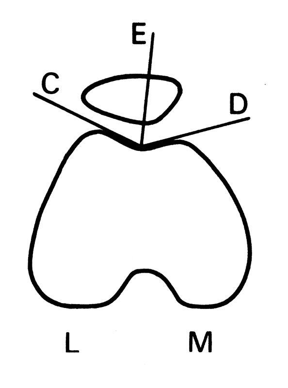 594x800 Disorders Of The Patellofemoral Joint