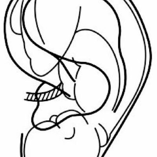 320x320 This Drawing Illustrates The Concept Of An Inverted Fetus Map
