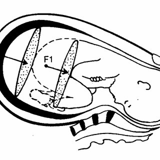 320x320 applied forces