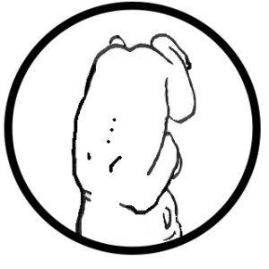 300x300 Right Occiput Anterior