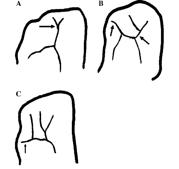 715x675 drawings of the anterior end patterns of the orbital sulci