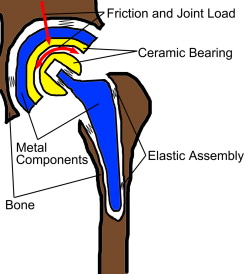 244x274 the influence of component design, bearing clearance and axial