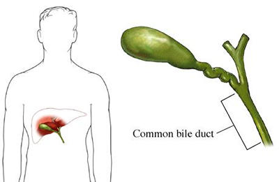 Gallbladder Drawing | Free download on ClipArtMag