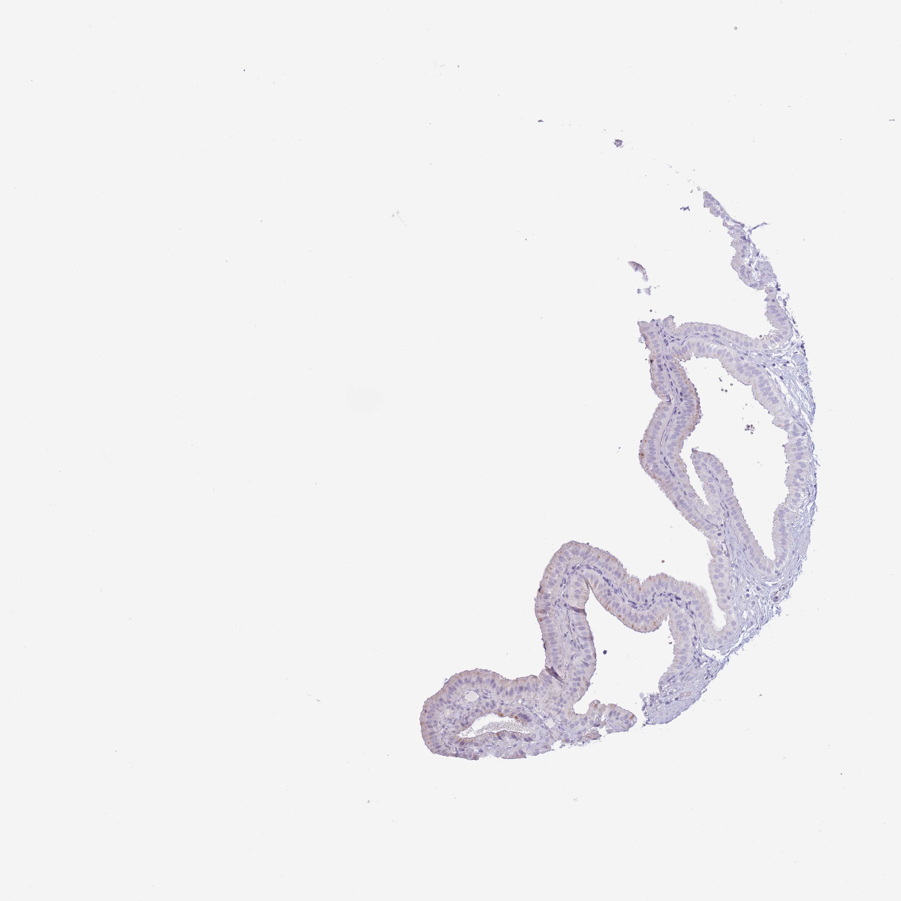 3000x3000 Tissue Expression