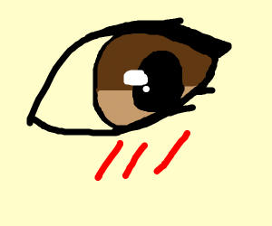 300x250 eye close up with scrapes on the cheek