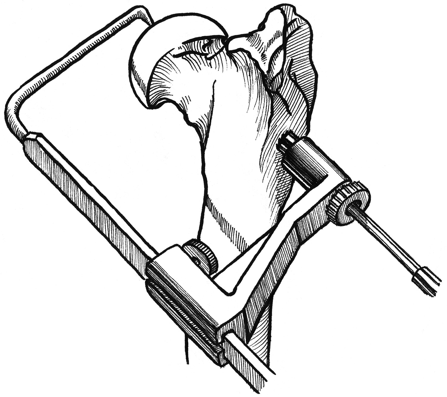 1500x1332 Hip Luxation Starter Kit