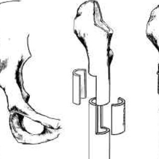 320x320 Distribution Of Hips