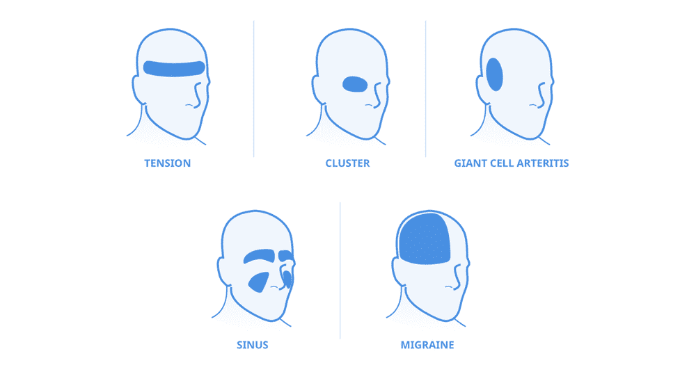 Headache Drawing | Free download on ClipArtMag