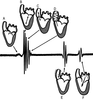 322x345 Heart Sounds