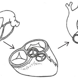 320x320 Segmental Analysis Of Congenital Heart Disease The Normal Heart