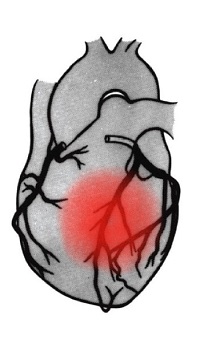 200x356 younger smokers eight times more likely to have a major heart
