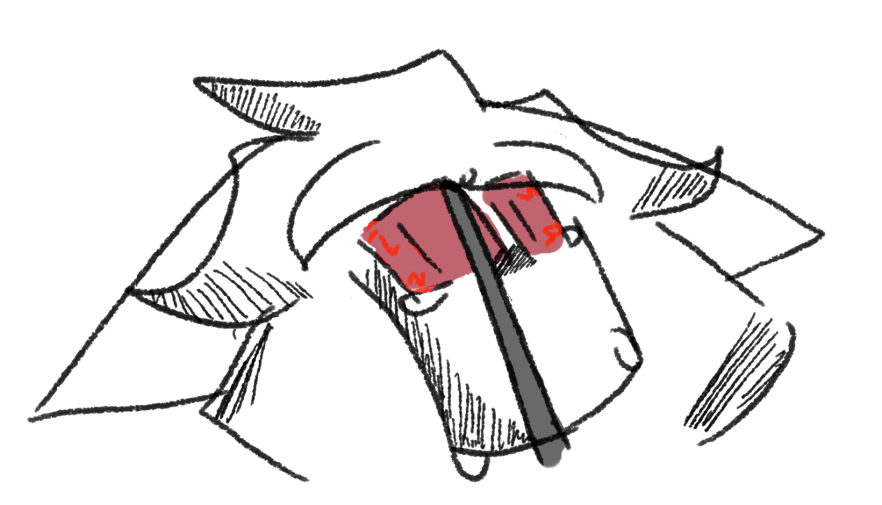 1280x733 Hide Your Tears Lobotomy Is A Neurosurgical