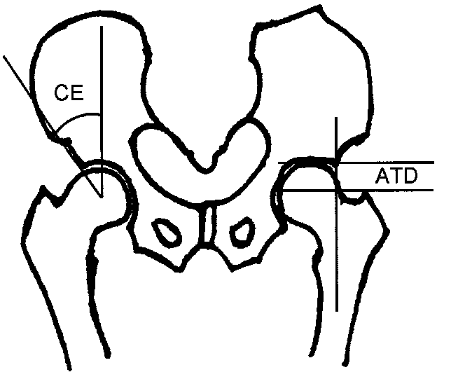 644x531 Schematic Drawing Showing The Ce Angle
