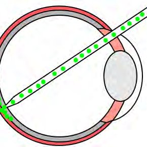 290x290 Schematic Drawing Of The Human Eye Adapted From Download