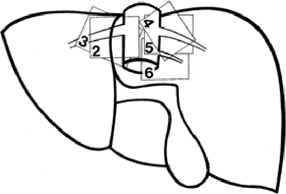 560x380 venous drainage of the dorsal sector of the liver differences