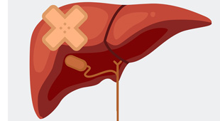 310x170 What Are The Different Stages Of Liver Fibrosis