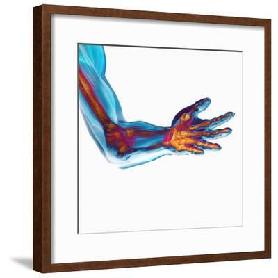 400x400 human elbow showing bones and muscles photographic print