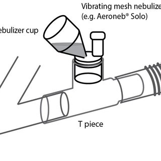 320x320 Direct Connection Of An Inhaler Device Within The Ventilator