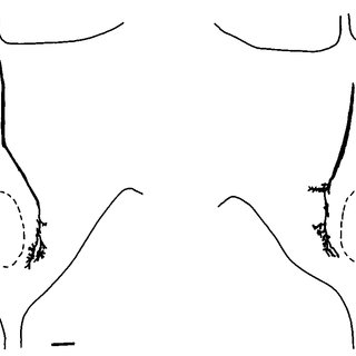 320x320 Drawings Of Single L Neurones Stained