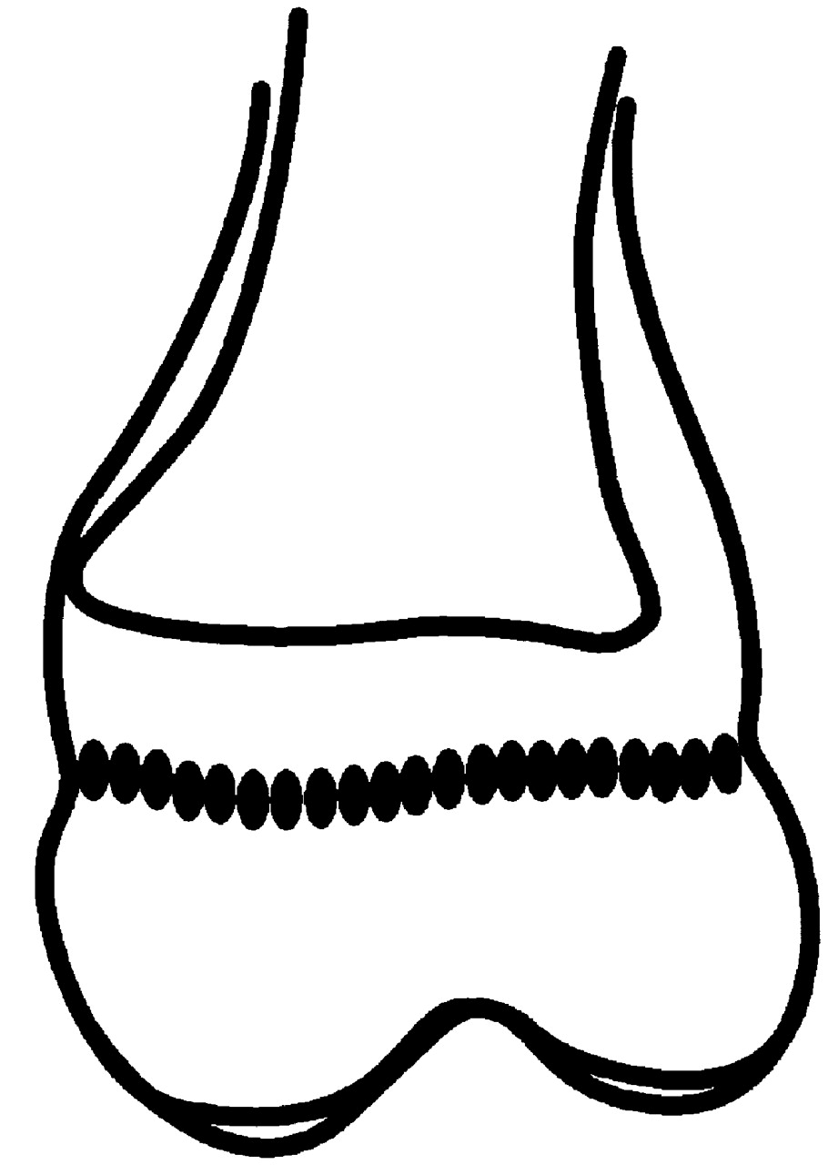 910x1280 Musculoskeletal Injury In Children Articles Pediatrics In Review