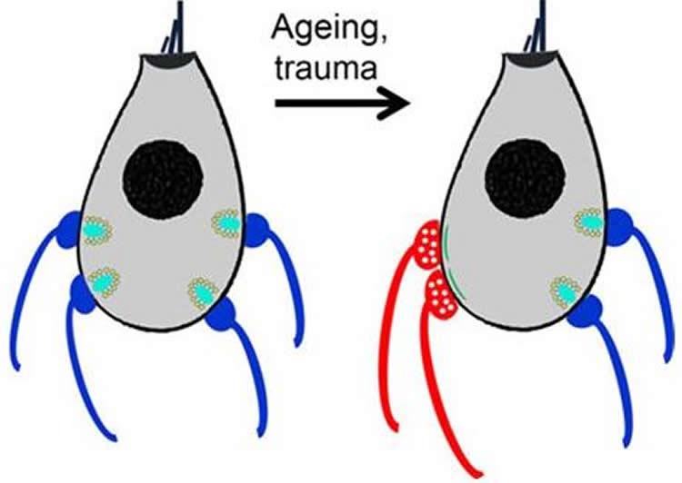 750x532 Researchers Discover Possible Contributor To Age Related Hearing