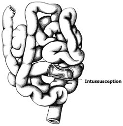 250x257 Intussusception Of The Intestines In Dogs Petcoach