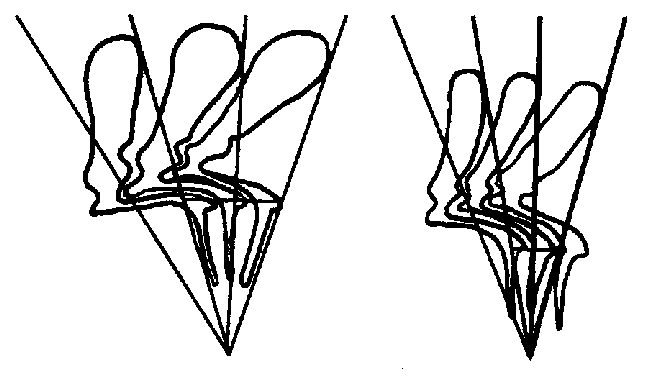 650x383 Diagrammatic Drawings Of The Denticles Of Two Specimens