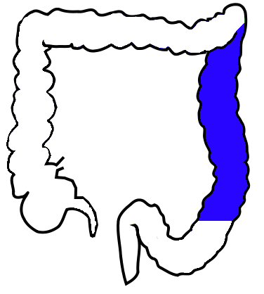 376x418 Descending Colon