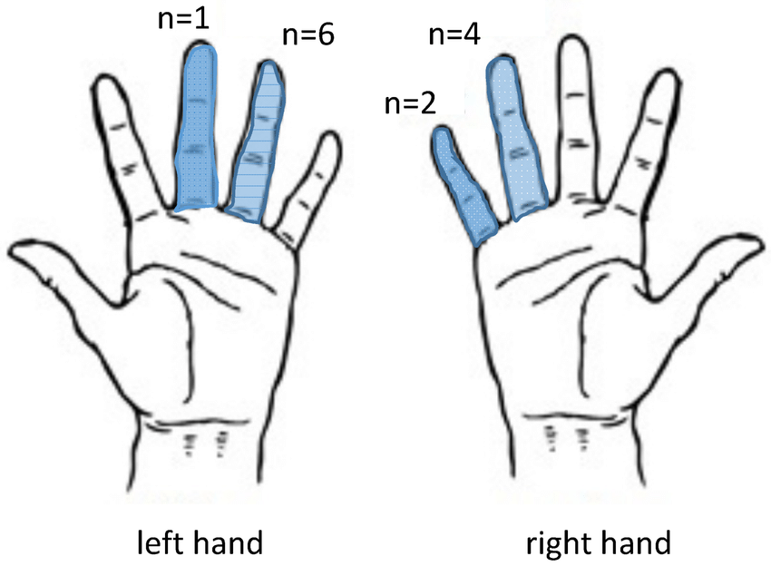 850x624 Distribution Of Lesions On The Fingers Of The Left And Right Hand