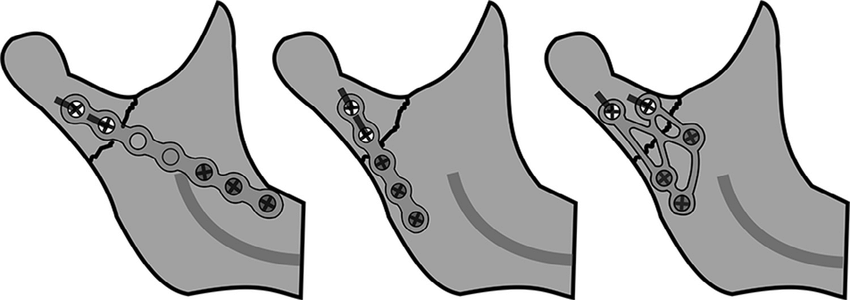 850x300 Schematic Drawing Of The Investigated Plate Designs