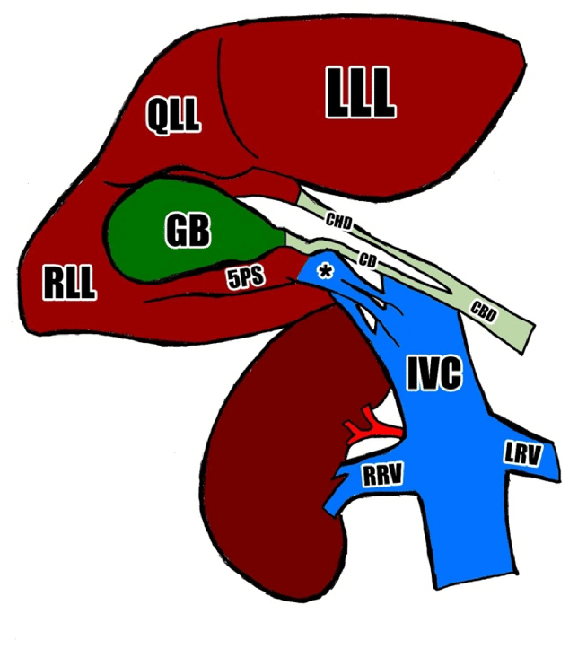 644x723 Schematic Drawing Of The Visceral View Of The Liver Download