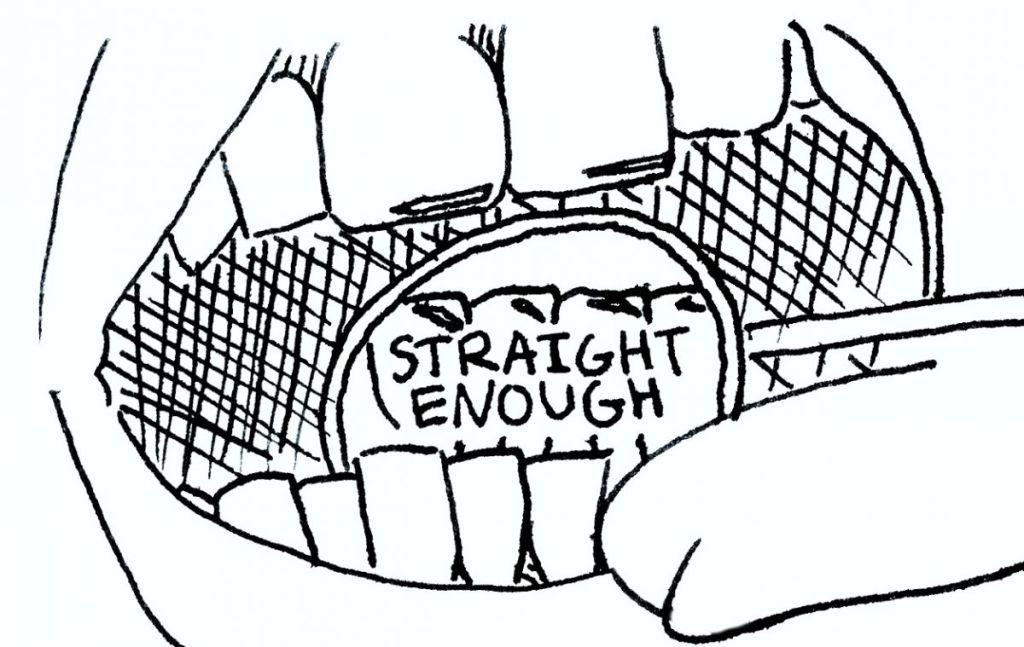 1024x647 Braces A Love Story Redwood Bark