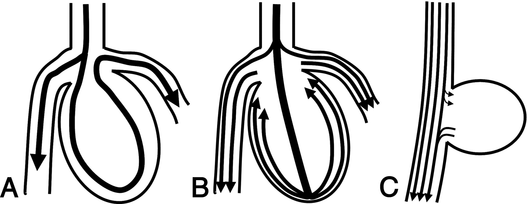 1800x697 Noninvasive Measurement Of Intra Aneurysmal Pressure And Flow