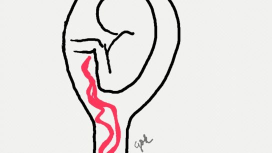 544x306 Breast, Lung, Brain, Bone Cancer News, Research Treatment Articles